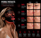 Multi-Spectrum LED Face Mask for Skin Wellness